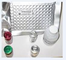 Sil-2R/Scd25 ELISA kit Sil-2R/Scd25 ELISA kit