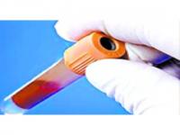 Anti-SCYLV(Sugarcane Yellow Leaf Virus) Antibody Anti-SCYLV(Sugarcane Yellow Leaf Virus) Antibody