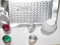 Anti-TIMP-1(Tissue Inhibitor of Metalloproteinase-1) Anti-TIMP-1(Tissue Inhibitor of Metalloproteinase-1)